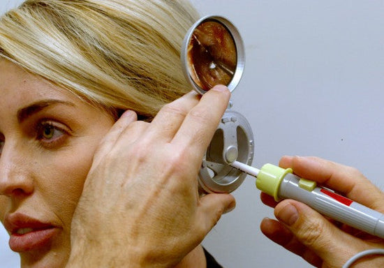 Clarifying MBS Item 41647: Microsuction, Medicare, and Safer Ear Care ...